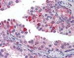 TAP1 Antibody in Immunohistochemistry (IHC)