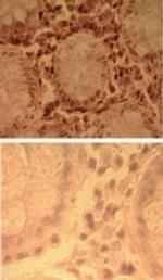 TLR7 Antibody in Immunohistochemistry (Paraffin) (IHC (P))