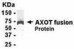 Axotrophin Antibody in Western Blot (WB)