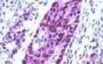 Cullin 1 Antibody in Immunohistochemistry (IHC)