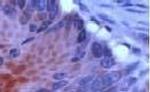 Protein APC Antibody in Immunohistochemistry (Paraffin) (IHC (P))