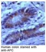 Protein APC Antibody in Immunohistochemistry (IHC)