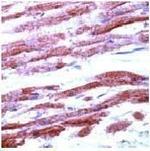 PAR4 Antibody in Immunohistochemistry (Paraffin) (IHC (P))