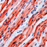 PAR4 Antibody in Immunohistochemistry (IHC)