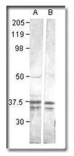 CaMKI Antibody in Western Blot (WB)