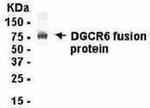 DGCR6 Antibody in Western Blot (WB)