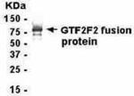 GTF2F1 Antibody in Western Blot (WB)