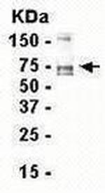 Tenascin C Antibody in Western Blot (WB)