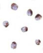 PHAP Polyclonal Antibody