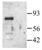 PAK1 Polyclonal Antibody
