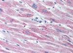 SOCS2 Antibody in Immunohistochemistry (IHC)