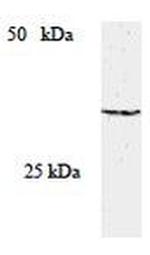 SOCS2 Antibody in Western Blot (WB)