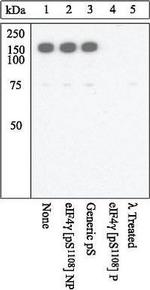 Phospho-EIF4G (Ser1108) Antibody in Western Blot (WB)