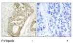 Phospho-PKC delta (Ser645) Antibody in Immunohistochemistry (Paraffin) (IHC (P))