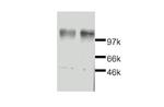 Leptin Receptor Polyclonal Antibody