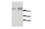 Leptin Receptor Antibody in Western Blot (WB)