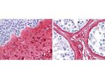 Collagen III Polyclonal Antibody