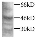 TGF beta-1 Polyclonal Antibody