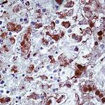 HSV Type 1 Antibody in Immunohistochemistry (Paraffin) (IHC (P))