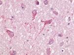 Lactoferrin Antibody in Immunohistochemistry (IHC)
