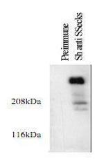AKAP12 Antibody in Western Blot (WB)