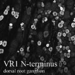 TRPV1 Antibody in Immunohistochemistry (IHC)