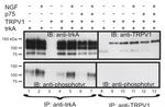 TRPV1 Antibody in Western Blot (WB)