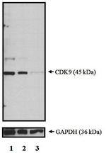 CDK9 Antibody
