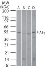 PIASy Polyclonal Antibody