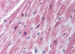 SOCS3 Antibody in Immunohistochemistry (IHC)