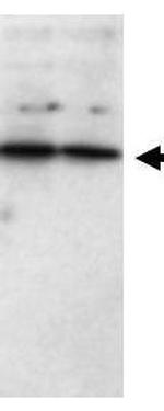 SFRP1 Antibody in Western Blot (WB)