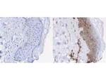 beta-2 Microglobulin Antibody in Immunohistochemistry (Paraffin) (IHC (P))