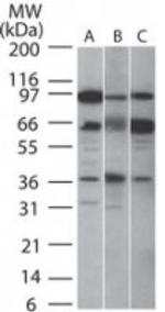 SIRT5 Antibody in Western Blot (WB)