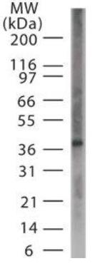 ASB11 Polyclonal Antibody