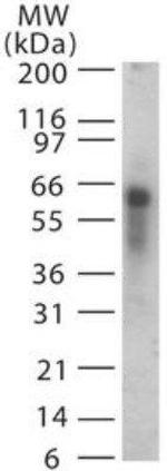 ASB3 Antibody in Western Blot (WB)