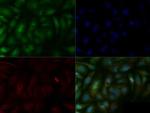 SMAD6 Polyclonal Antibody