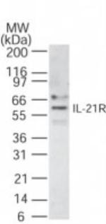 IL21R Polyclonal Antibody