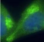ACTH Antibody in Immunocytochemistry (ICC/IF)
