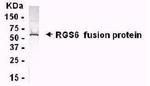 RGS6 Antibody in Western Blot (WB)