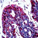 p14ARF Antibody in Immunohistochemistry (IHC)