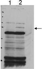 PNK Antibody in Western Blot (WB)