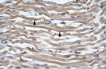 DLX2 Polyclonal Antibody