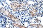 CLIC1 Polyclonal Antibody