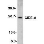 CIDEA Antibody in Western Blot (WB)