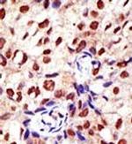 PRMT2 Polyclonal Antibody