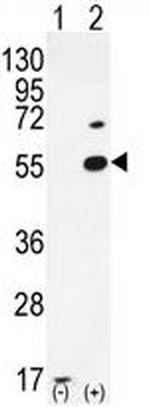 PRMT2 Antibody in Western Blot (WB)