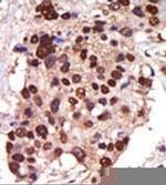 PRKD3 Antibody in Immunohistochemistry (Paraffin) (IHC (P))