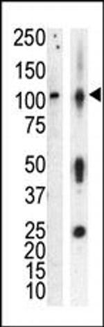 PRKD3 Antibody in Western Blot (WB)