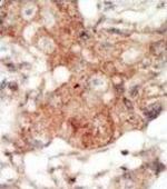 EphA4 Polyclonal Antibody