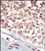 EphA5 Antibody in Immunohistochemistry (Paraffin) (IHC (P))